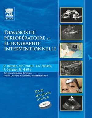 Diagnostic Périopératoire Et échographie Interventionnelle - 9782810100880