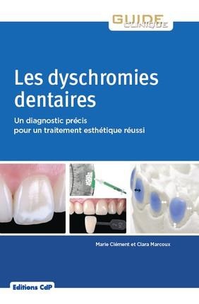 Les dyschromies dentaires - 9782843614217