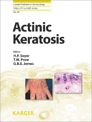 Actinic Keratosis - 9783318027624