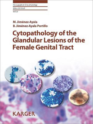 Cytopathology of the Glandular Lesions of the Female Genital Tract - 9783805594646