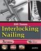Interlocking Nailing - 9788184488821