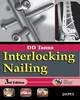 Interlocking Nailing