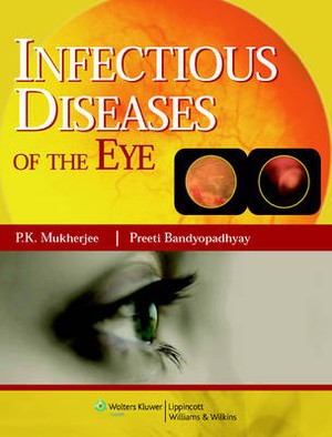 Infectious Diseases of the Eyes - 9788184731989