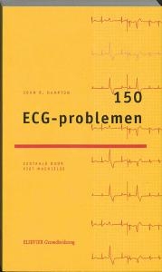 150 ECG-problemen