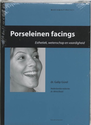 Porseleinen facings