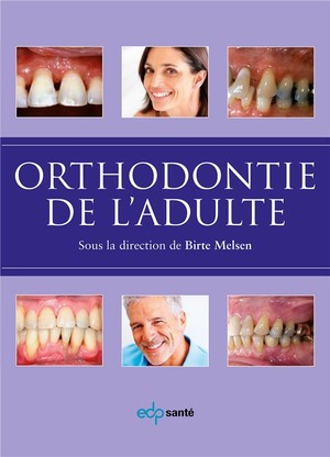 Orthodontie de l'adulte - 9791090762039